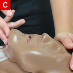 CPR Figure 20 C Gently tilt the head back while lifting the chin