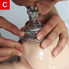 CPR Figure 27 C Give a breath for over one second and watch the chest rise